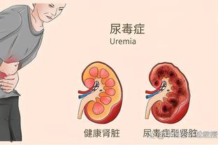 高阶数据EPM攻防均前15%球员：詹姆斯&恩比德&莱昂纳德领衔